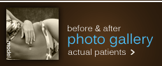 before and after photos