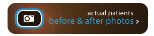 facial rejuvenation photo gallery
